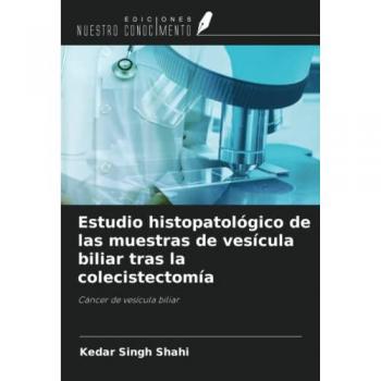 Shahi, Kedar Singh: Estudio histopatológico de las muestras de vesícula biliar tras la colecistectomía
