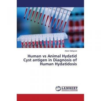 Human vs Animal Hydatid Cyst antigen in Diagnosis of Human Hydatidosis