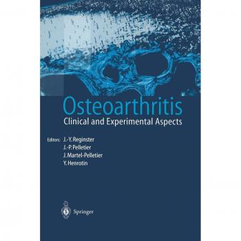 Osteoarthritis