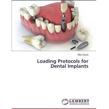 Loading Protocols for Dental Implants
