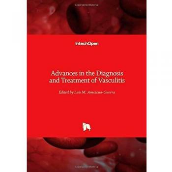 Advances in the Diagnosis and Treatment of Vasculitis