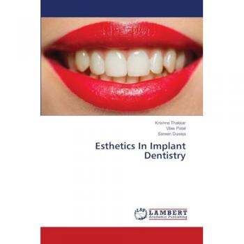Esthetics In Implant Dentistry