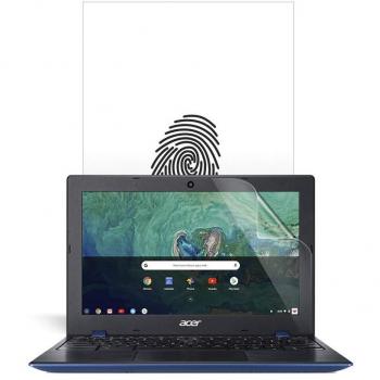 Chromebook ClearVision – Mild VividPlus Screen Protector (2pcs)