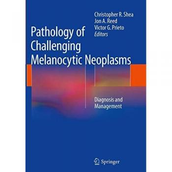 Pathology of Challenging Melanocytic Neoplasms