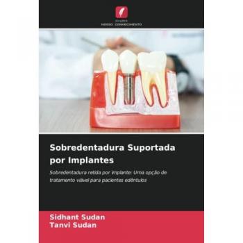 Sobredentadura Suportada por Implantes: Sobredentadura retida por implante: Uma opção de tratamento viável para pacientes edêntulos