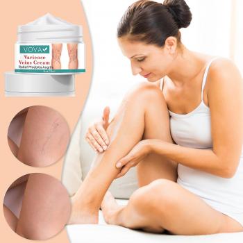 Exsha Vova 30ml Crème Varicose