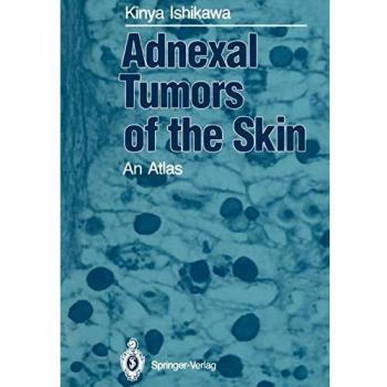 Adnexal Tumors of the Skin