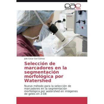 Sorí Gómez, Julio Cesar: Selección de marcadores en la segmentación morfológica por Watershed