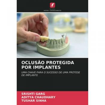 OCLUSÃO PROTEGIDA POR IMPLANTES: UMA CHAVE PARA O SUCESSO DE UMA PRÓTESE DE IMPLANTE