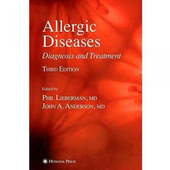 Allergic Diseases: Diagnosis and Treatment
