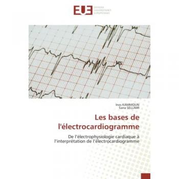 Les bases de l'électrocardiogramme: De l’électrophysiologie cardiaque à l’interprétation de l’électrocardiogramme