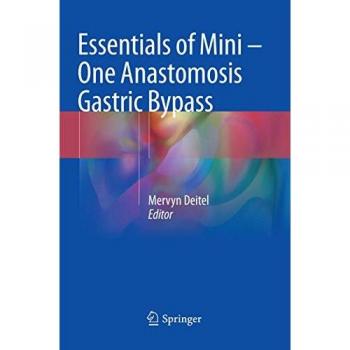 Essentials of Mini ' One Anastomosis Gastric Bypass