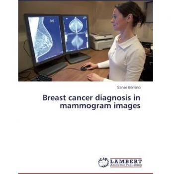 Breast cancer diagnosis in mammogram images