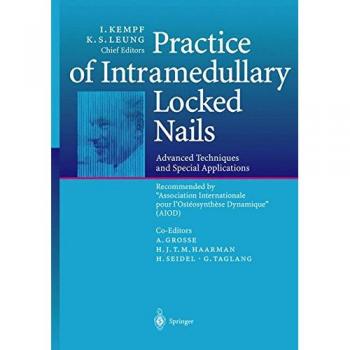 Practice of Intramedullary Locked Nails