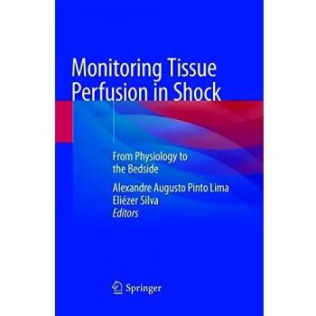 Monitoring Tissue Perfusion in Shock