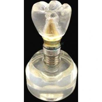 Dental Implant Study Teeth Model