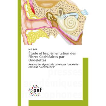 Ãtude et ImplÃ©mentation des Filtres CochlÃ©aires par Ondelettes: Analyse des signaux de parole par l'ondelette continue Gammachirp