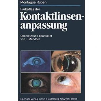 Farbatlas der Kontaktlinsenanpassung