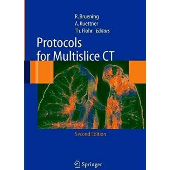 Protocols for Multislice CT