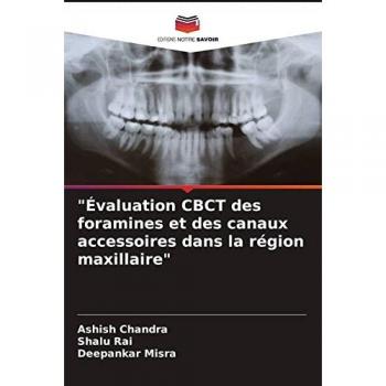 Évaluation CBCT des foramines et des canaux accessoires dans la région maxillaire