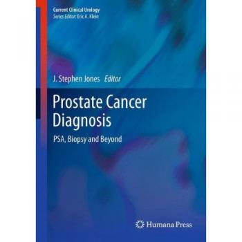 Prostate Cancer Diagnosis: PSA, Biopsy and Beyond (Current Clinical Urology)