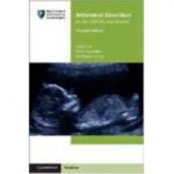 Antenatal Disorders for the MRCOG and Beyond
