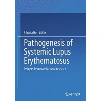 Pathogenesis of Systemic Lupus Erythematosus: Translational Research Insights