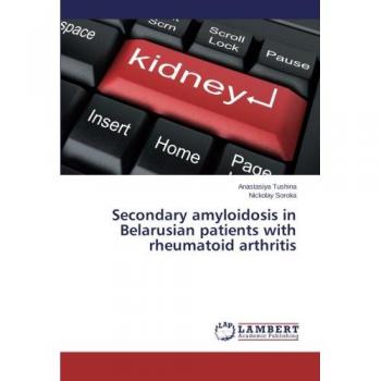 Secondary amyloidosis in Belarusian patients with rheumatoid arthritis