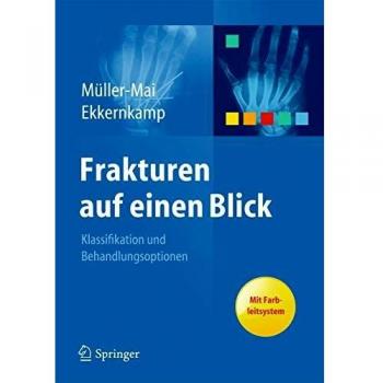 Frakturen auf einen Blick