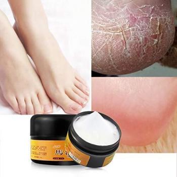 Allbestaye Huile de cheval Réparation Main Pied Se Soucier Exfoliant Crème Anti Engelures Sec Fissures Et Fissures Guérir Pommade (6)
