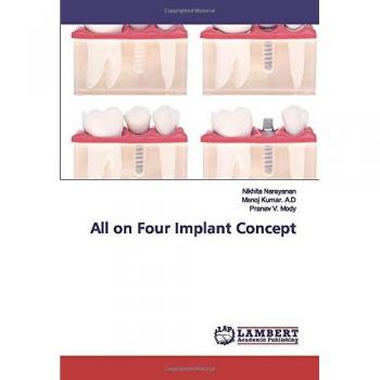 All on Four Implant Concept