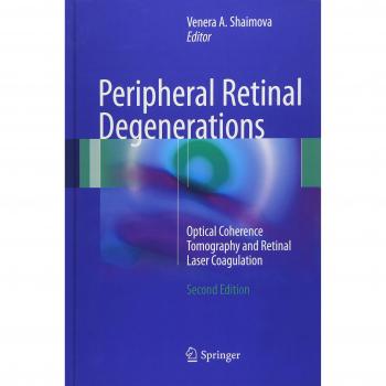 Peripheral Retinal Degenerations