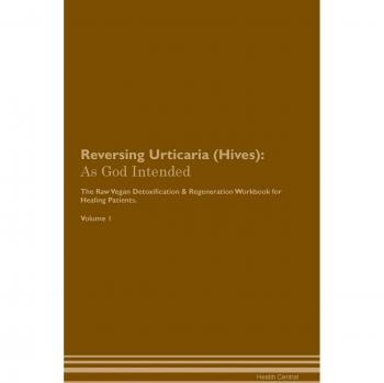 Reversing Urticaria