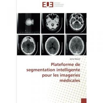 Plateforme de segmentation intelligente pour les imageries médicales