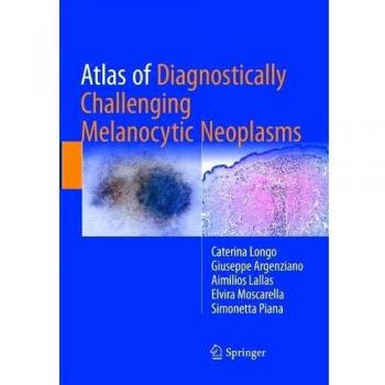 Atlas of Diagnostically Challenging Melanocytic Neoplasms, Fachbücher von Giuseppe Argenziano, Aimilios Lallas, Simonetta Piana, Caterina Longo, Elvira Moscarella