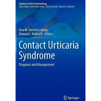 Contact Urticaria Syndrome: Diagnosis and Management