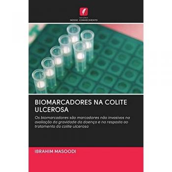 BIOMARCADORES NA COLITE ULCEROSA: Os biomarcadores são marcadores não invasivos na avaliação da gravidade da doença e na resposta ao tratamento da colite ulcerosa