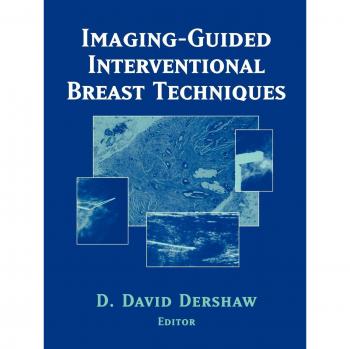 Imaging-Guided Interventional Breast Techniques