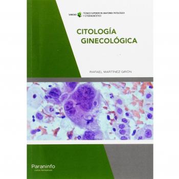 Citología ginecológica