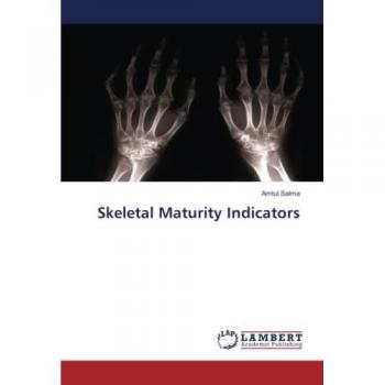 Skeletal Maturity Indicators: DE