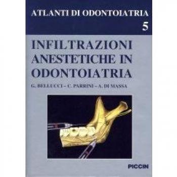 Infiltrazioni anestetiche in odontoiatria