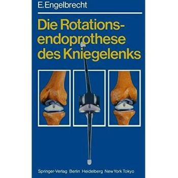 Die Rotationsendoprothese des Kniegelenks