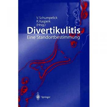 Divertikulitis