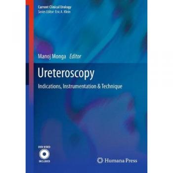 Ureteroscopy: Indications, Instrumentation & Technique
