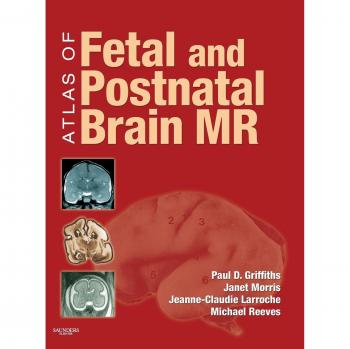 Atlas of Fetal and Postnatal Brain MR