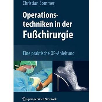 Operationstechniken in der Fußchirurgie: Eine praktische OP-Anleitung