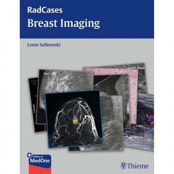 Radcases Breast Imaging