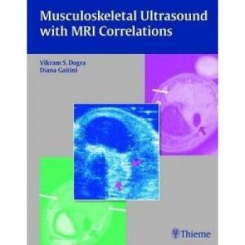 Musculoskeletal Ultrasound with MRI Correlations