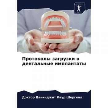 Протоколы загрузки в дентальные имплантаты