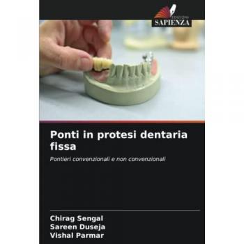 Ponti in protesi dentaria fissa: Pontieri convenzionali e non convenzionali